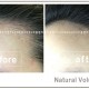 PLANB MAKEUP 볼륨헤어라인 전후 (6)-10