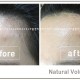 PLANB MAKEUP 볼륨헤어라인 전후 (6)-12