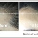 PLANB MAKEUP 볼륨헤어라인 전후 (6)-13